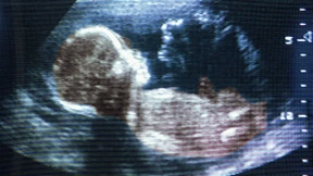 Ekelst du dich noch – oder isst du schon?