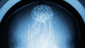 Bring mir den Kopf von Raymond Kurzweil!