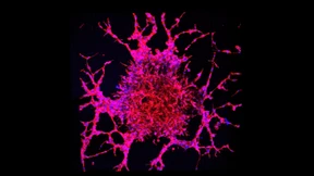 Hoffnung im Kampf gegen Schilddrüsenkrebs