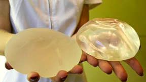 Bundesinstitut rät: Silikonkissen entfernen lassen