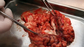 BSE-Fall in Brandenburg zieht weitere Kontrollen nach sich