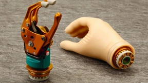 Prothesen-Hersteller Ottobock sucht Investoren