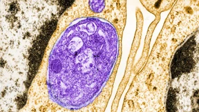 „Lipid-Rafts“ in unseren Zellen
