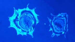 Mit Dreierkombination gegen Leberkrebs und Lebermetastasen