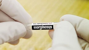 Morphosys enttäuscht mit Studiendaten