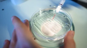 Keine Angst vor der Genschere