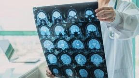 Bessere Chancen für Menschen mit Hirnschäden