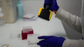 Möglicherweise neue Corona-Variante in Bayern entdeckt