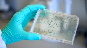 Noch mehr Fördergeld für Curevac