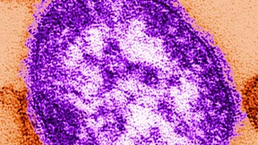 Erster Todesfall in Amerika seit zwölf Jahren 