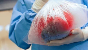 „Die Deutsche Stiftung Organspende ist vom Skandal nicht betroffen“