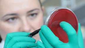 Innovative Krebstherapien