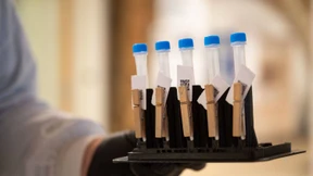 Sieben-Tage-Inzidenz fällt auf 432,2