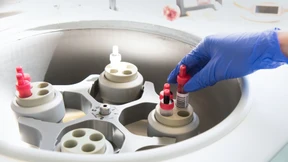 Projekt gegen Lungenkrebs