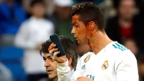 Blutiges Ende für Ronaldo bei Reals Torfestival