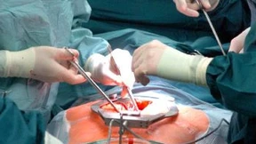 Warnzeichen für Herzinfarkt 