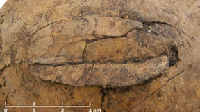 Steinzeitlicher Massenmord bei Frankfurt