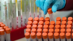 Plastikmangel bedroht die Corona-Tests