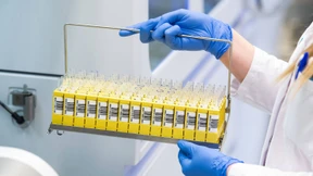 249 Euro für einen Corona-Test?