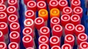 Hessen meldet einen Höchstwert