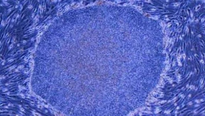 Die Anbeter des Methusalem