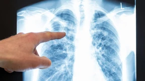 Das Röntgenbild vom eigenen Tod