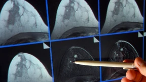 Nanocontainer für empfindliches Frachtgut