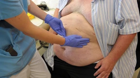 Gesund mit Übergewicht 