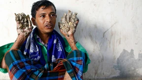 „Baum-Mann“ hofft auf normales Leben