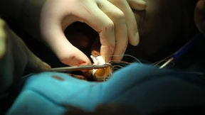 Zellen sagen Erholungsphase nach der OP voraus