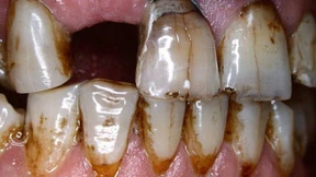 Tabak-Klage in Australien abgewiesen