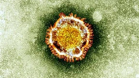 Ein Virus, das reiche Männer befällt