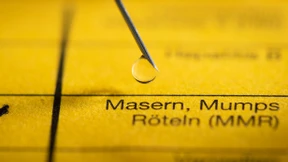 Britische Behörde besorgt wegen Häufung bei Masern