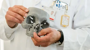 Hartplastik-Knochen aus dem 3D-Drucker