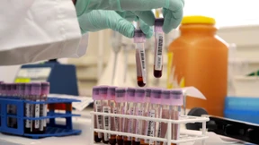 Ausgerechnet die Anti-Doping-Streber