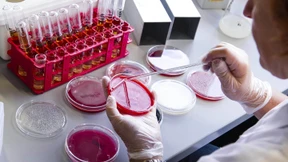 Neues Antibiotikum wirkt gegen multiresistente Keime