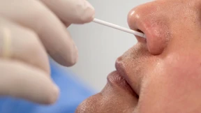 RKI registriert 592 Neuinfektionen