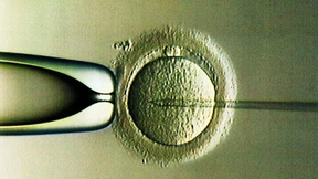 Das Risiko der Retortenkinder