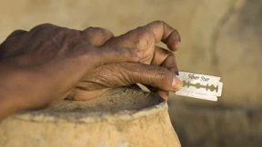 Genitalverstümmelung noch immer gängige Praxis