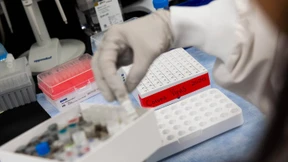 Biotech-Aktien sind in der Corona-Krise gefragt