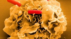 Der Darm ist unser zweites Gehirn