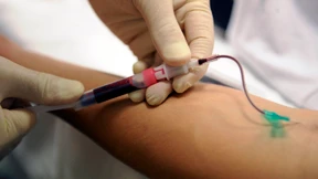 Staatsanwalt: Kann Doping sein