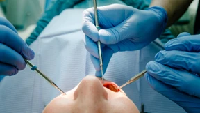 Zahnärzte fordern mehr Schutz