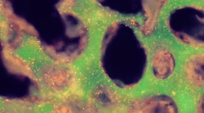 Gel schützt Nano-Sensoren unter der Haut