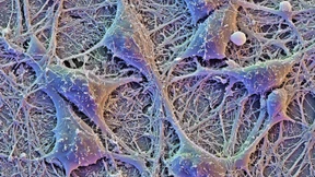 Wie das Gehirn den Verlust von Nervenzellen kompensiert