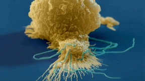 Immun-Chaos durch Covid-19