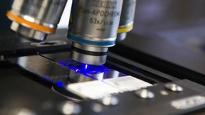 So schürfen nun die Goldgräber im Genom