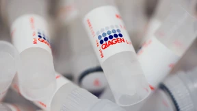 Qiagen-Aktienkurs steigt auf historisches Hoch