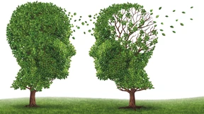 Alzheimer – Forschung notwendiger denn je