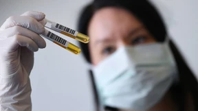 Hoffnung für Covid-19-Patienten